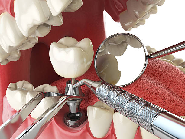 Best Broken or Cracked Tooth Emergency Dentist in South Hempstead, NY