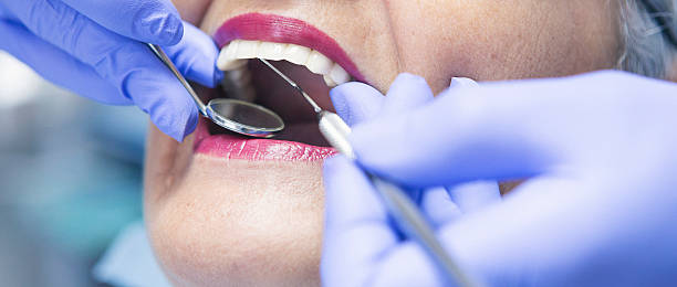 Best Emergency Dentist for Lost Fillings or Crowns in South Hempstead, NY